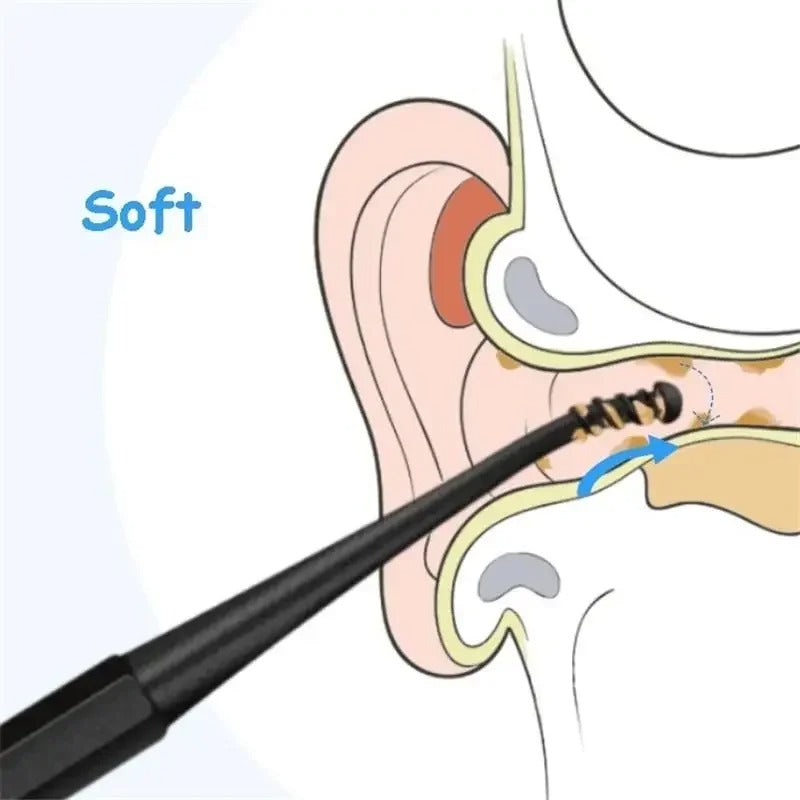 Earwax remover